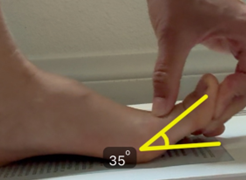 toe bend at 35 degrees